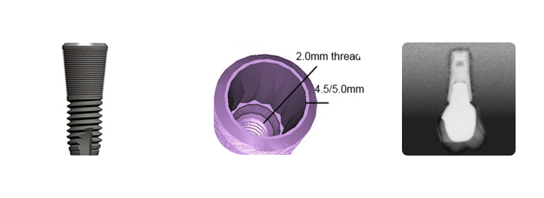 Astra® - Preat Corporation